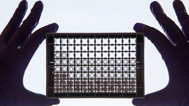 CAMBRIDGE, UNITED KINGDOM - DECEMBER 09: A scientist examining cells in a 96-well plate. These plates allow scientists to look at lots of cells at the same time and directly compare cells that have or have not been treated with a drug, at the Cancer Research UK Cambridge Institute on December 9, 2014 in Cambridge, England. Cancer Research UK is the world's leading cancer charity dedicated to saving lives through research. Its vision is to bring forward the day when all cancers are cured. They have saved millions of lives by discovering new ways to prevent, diagnose and treat cancer, and as such the survival rate in the UK has doubled in the last 40 years. Cancer Research UK funds over 4,000 scientists, doctors and nurses across the UK, more than 33,000 patients who join clinical trials each year and a further 40,000 volunteers that give their time to support the work. (Photo by Dan Kitwood/Getty Images/Cancer Research UK)