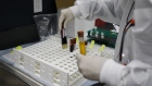 A health worker holds blood samples during clinical trials for a Covid-19 vaccine in Hollywood, Florida.