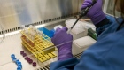 A scientist uses a pipette and plastic vials whilst working on stem cells inside a stem cell research laboratory at the GlaxoSmithkline Plc Research and Development center in Stevenage, U.K., on Tuesday, Nov. 26, 2019. Glaxo is exploring the trillions of microbes that inhabit the gut in pursuit of novel ways to prevent some of the world’s most common ailments.