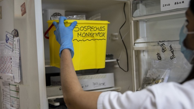 A medical laboratory technician picks up suspected monkeypox samples to be tested at the microbiology laboratory of La Paz Hospital in Madrid. Photographer: Pablo Blazquez Dominguez/Getty Images
