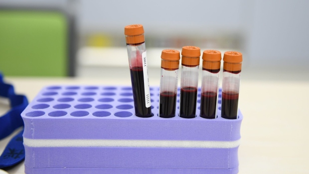 Blood samples on a table during a Covid-19 antibody test at Chiba University Hospital in Chiba, Japan, on Wednesday, Dec. 1, 2021. While daily coronavirus cases have remained low in Japan, concerns about another wave of infections grew further as the country recorded its second case of omicron variant on Wednesday.