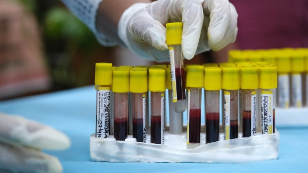 A health worker handles a tray of blood samples from members of the public at a health dispensary participating in a national serological survey to ascertain the proportion of the population that have developed Covid-19 antibodies, in New Delhi, India, on Monday, Sept. 27, 2021. India's expansion in services and manufacturing activity coincided with relatively low new Covid-19 cases and a pick up in the pace of vaccinations -- more than 834 million doses have been administered so far in the nation of 1.3 billion people.