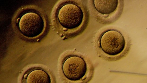Human embryos on a petri dish are viewed through a microscope at the La Jolla IVF Lab in La Jolla, California, U.S., on Tuesday, March 24, 2009. President Barack Obama earlier this month lifted restrictions on federal funding for embryonic stem-cell research and called on Congress to provide more money for such study to make the U.S. a leader in the field. Photographer: SANDY HUFFAKER/Bloomberg News