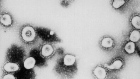 A microscopic view of the SARS-CoV-2 virus particles. Photographer: CDC/Getty Images