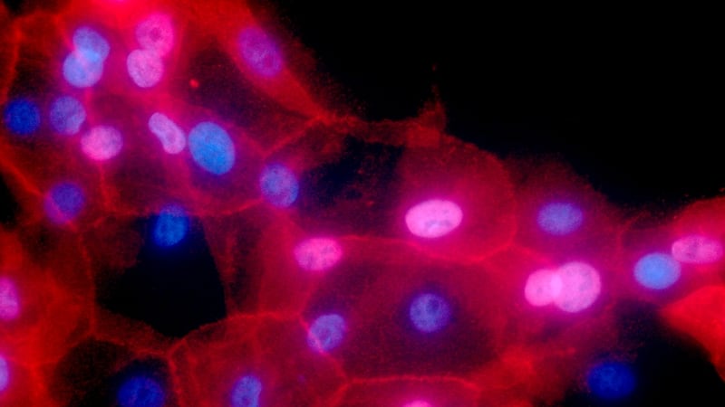 Hot Picks: Life sciences stocks are seen poised for growth